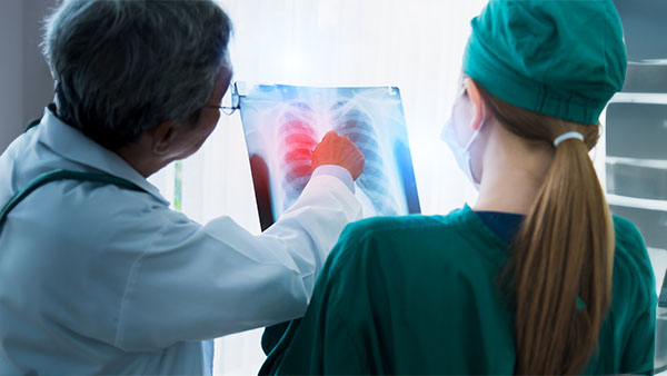 Healthcare professionals reviewing images of lungs